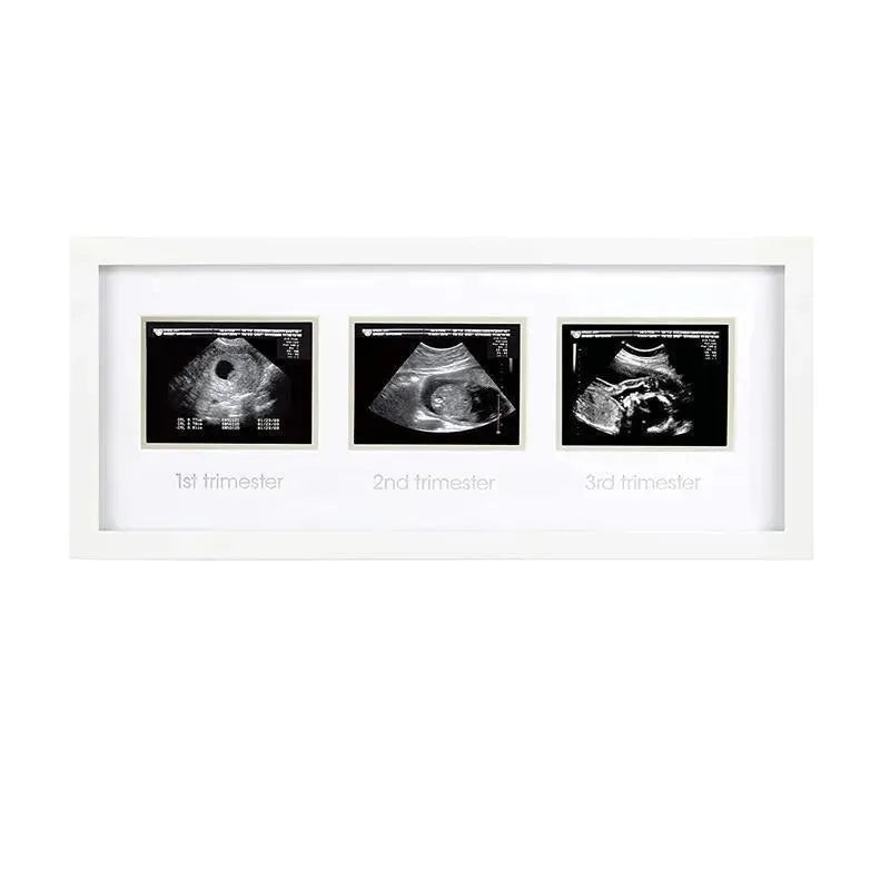 Pearhead – Trimester Sonogram Frame, White