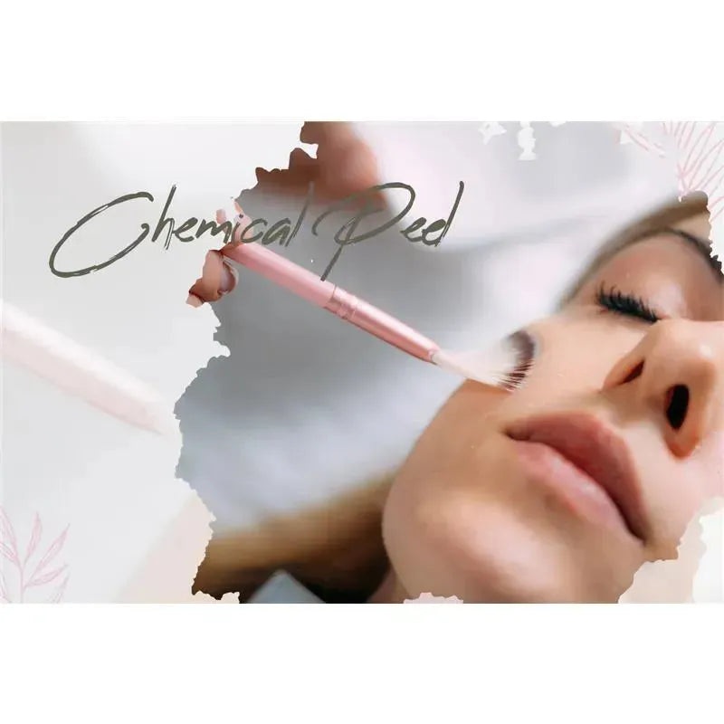 Macro Beauty Spa – Chemical Peel | Orlando, FL