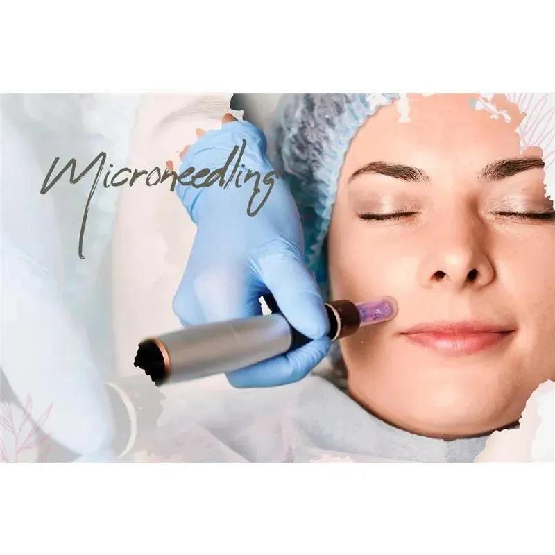 Macro Beauty Spa – Microneedling | Orlando, FL